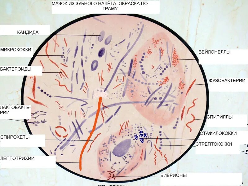 Микрофлора языка. Микроскопия зубного налета. Микрофлора зубного налета микробиология. Мазок из зубного налета микробиология. Микрофлора зубного налета под микроскопом.