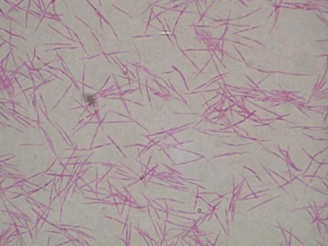 Sneathia spp. Fusobacterium spp микроскопия. фузобактерии микробиология.
