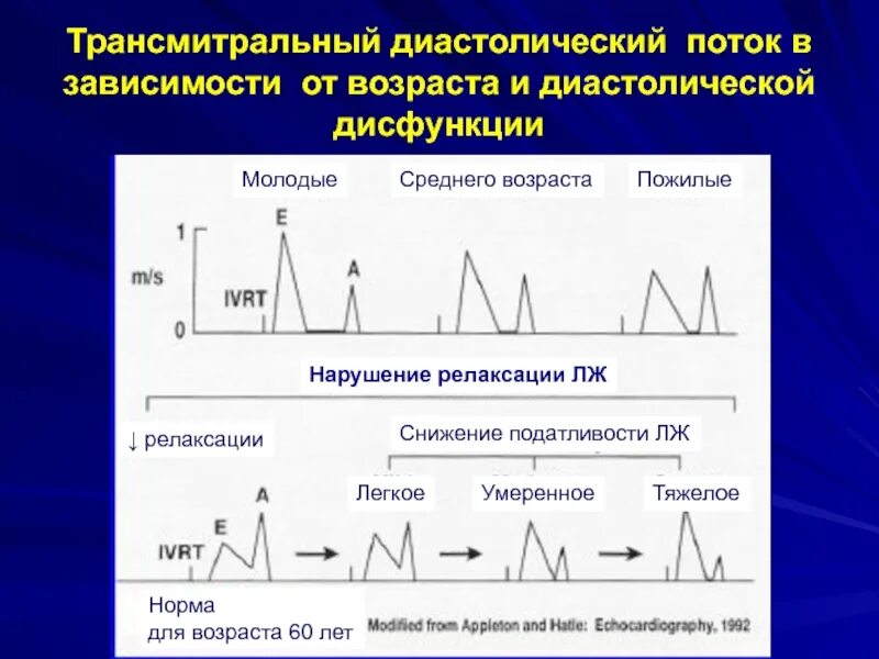 Дисфункции желудочков сердца. Диастолическая дисфункция левого желудочка 2 степени. Диастолическая дисфункция 2 типа ЭХОКГ. Нарушение диастолической функции типы. Типы нарушения диастолической функции лж.