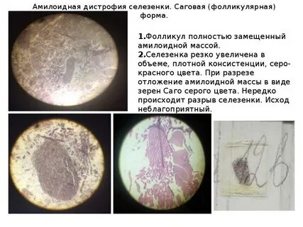 2 селезенки