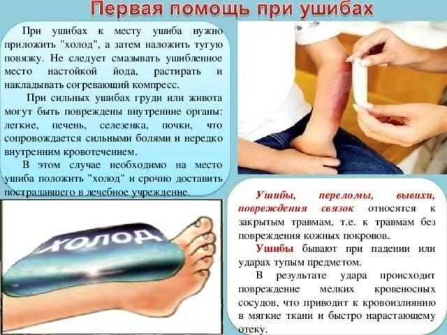 Сильно упала что делать. Оказание первой помощи при ушибе ноги. при ушибах в первую необходимо. что делать при ушибе первая помощь.