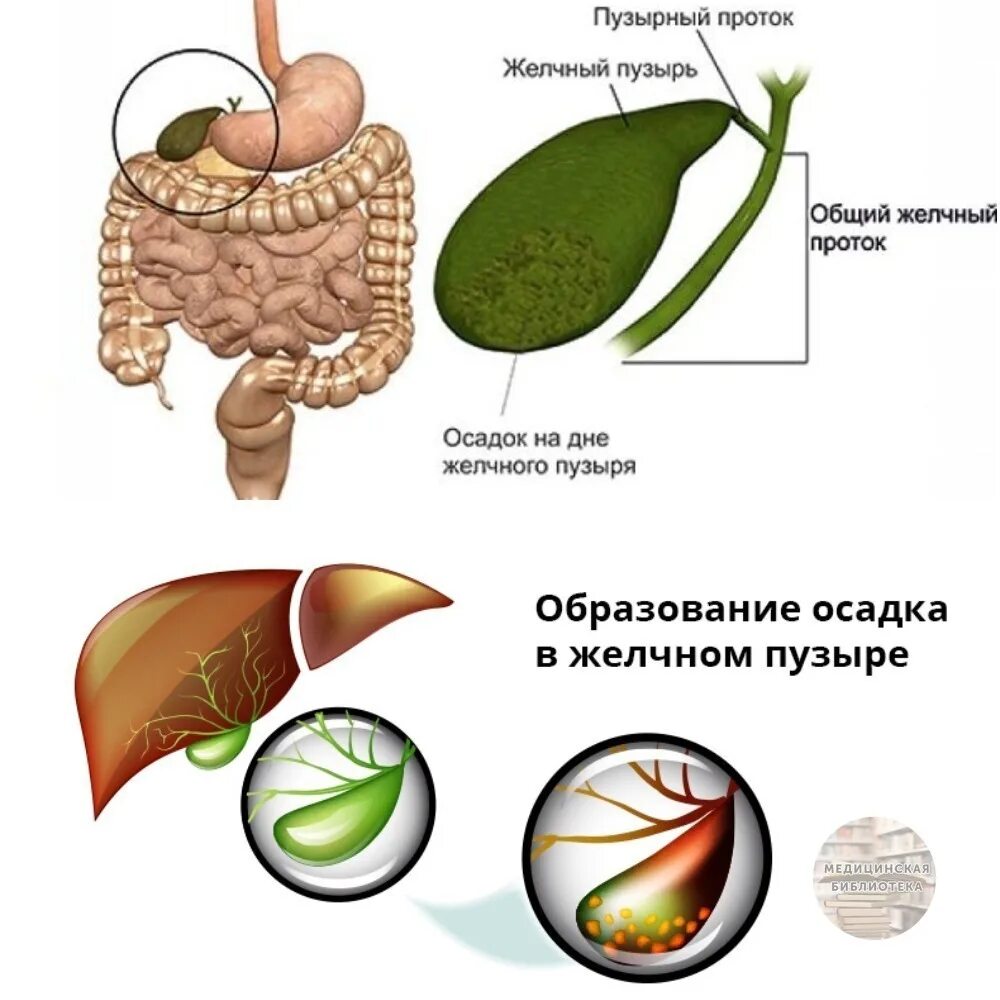 Желчный пузырь застой отзывы