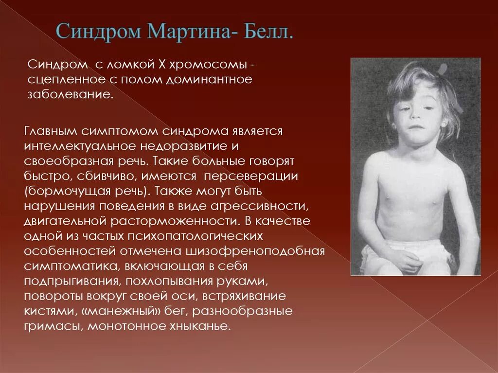 4 хромосома заболевание. Синдром умственной отсталости с ломкой х-хромосомой.