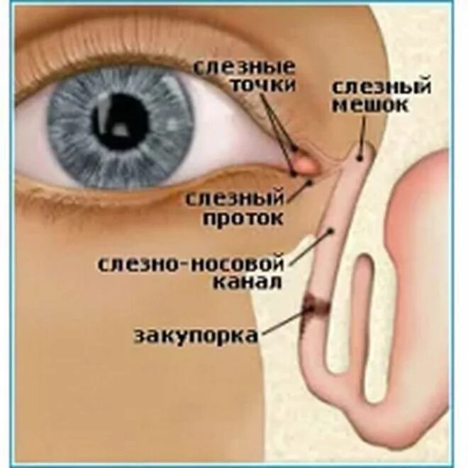 Носослезный канал открывается в носовой. Заболевание слезного аппарата дакриоцистит. Дакриоцистит воспаление слезного канала. Слёзные канальцы функции и строение. Анатомия глаза слезный мешок.
