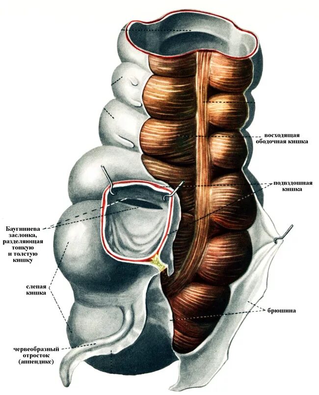 Хорошо развита слепая кишка. Слепая кишка баугиниевая заслонка. Слепая кишка кишки анатомия. Илеоцекальный угол топографическая анатомия. Илеоцекальный клапан баугиниева заслонка.