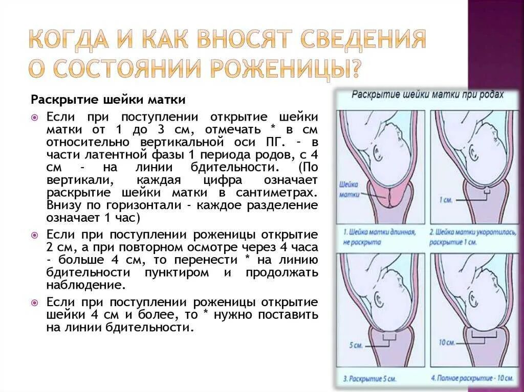 Этапы раскрытия шейки матки перед родами. Роды раскрытие шейки матки на 2 пальца. Раскрытие шейки матки при 3 родах. Открытие шейки. Сколько пальцев рожают