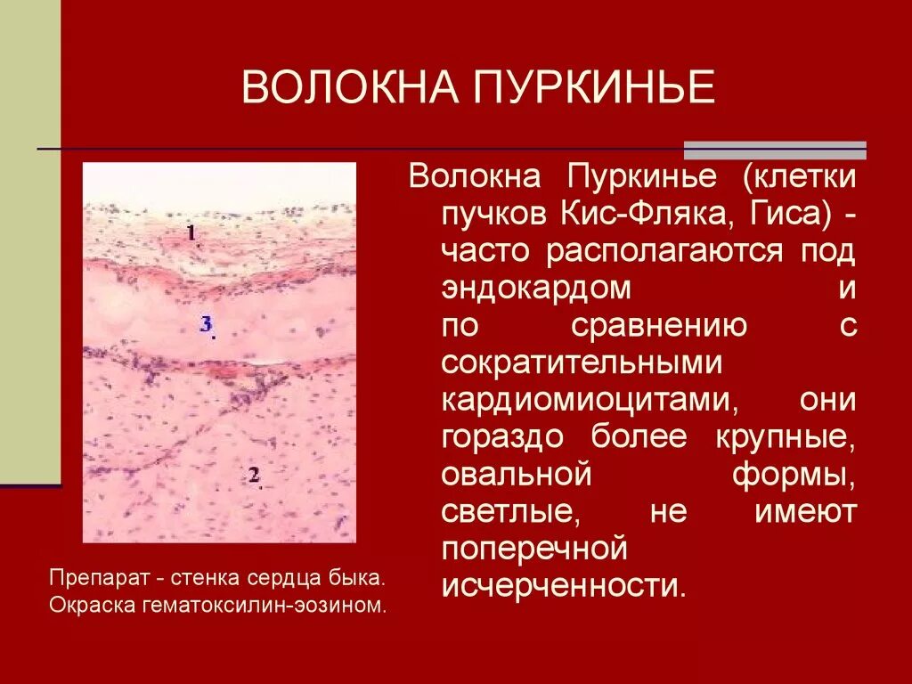 Пучок пуркинье. Волокна Пуркинье препарат гистология. Волокна Пуркинье гематоксилин эозин. Волокна Пуркинье в стенке сердца гистология препарат. Волокна Пуркинье в сердце гистология.