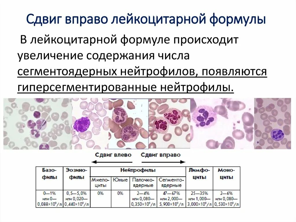 Реактивные изменения лейкоцитов. Мазок крови лейкоцитарная формула. Лейкоцитарная формула методика подсчета лейкоцитов. Морфология сегментоядерных нейтрофилов. Лейкоцитарная формула крови микроскопия.