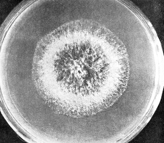 Колонии грибов в чашке петри. Aspergillus fumigatus колонии. Аспергиллус колония на чашках Петри. Мицелий актиномицетов в чашке Петри. Аспергиллез возбудитель.