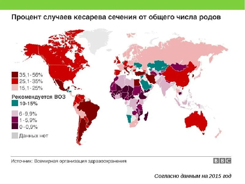 Сколько платят за кесарево. Статистика кесарева сечения в мире на 2021. Частота кесарева сечения в мире 2021. Процент кесаревых сечений в России 2020. Статистика кесарева сечения в России 2021.