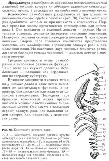 Ходильные ноги 2