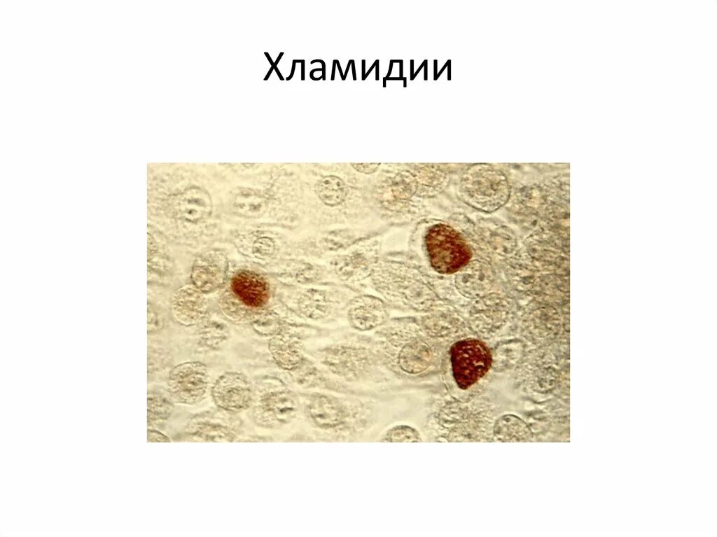 Chlamydia trachomatis под микроскопом.