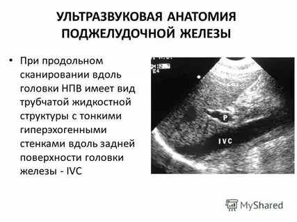 Узи почек поджелудочной железы