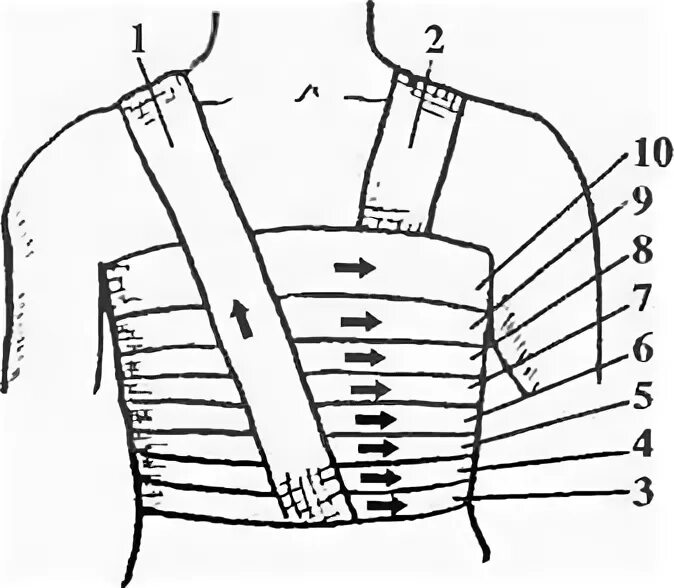 Техника наложения повязок на грудную клетку. Наложение спиральной повязки на грудную клетку. Технику наложения спиральной повязки на грудную клетку.. Спиралевидная повязка на грудную клетку алгоритм. Перевязка грудной клетки алгоритм.
