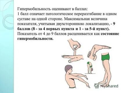 Подвижность конечностей