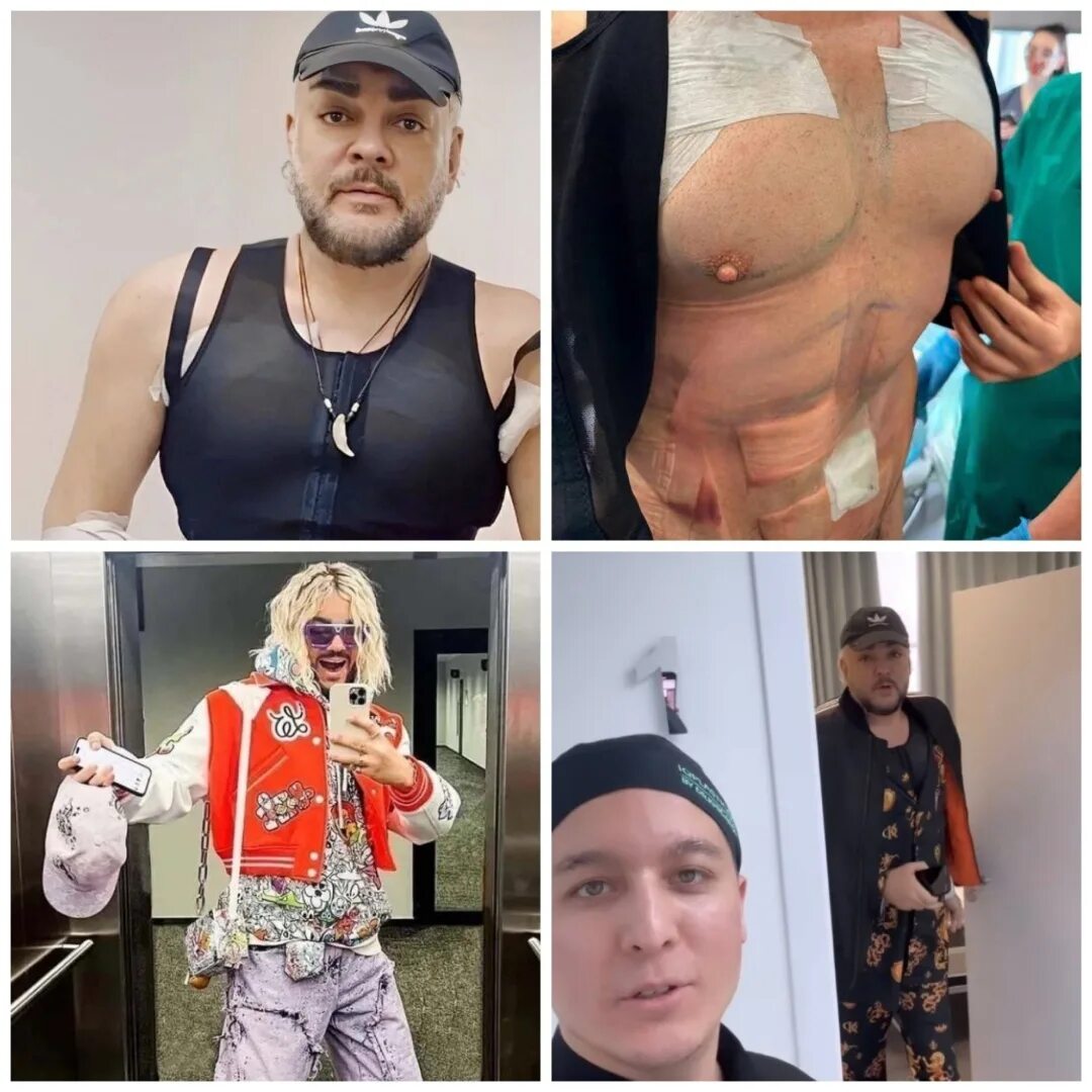 Киркоров сейчас 2023. Накаченный пресс. Филипп киркоров 2023 пресс. Филипп киркоров пластика 2023. Киркоров после операции.