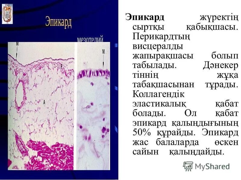 Эндокард миокард эпикард гистология. Стенки миокард гистология препарат. Стенка сердца миокард гистология. Эпикарди перикард гистология. Эпикард гистология.