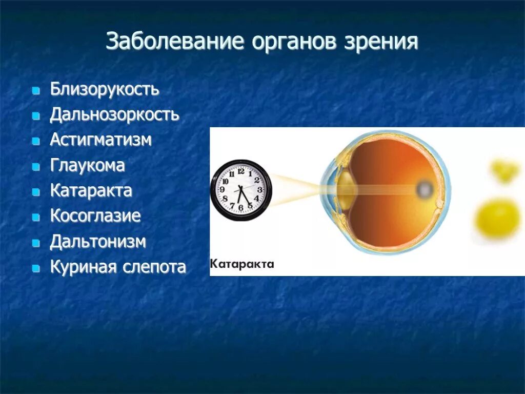 Близорукость причины возникновения. Заболевания органов зрения. Патологии органов зрения. Нарушение органов зрения. Нарушение зрения заболевания.