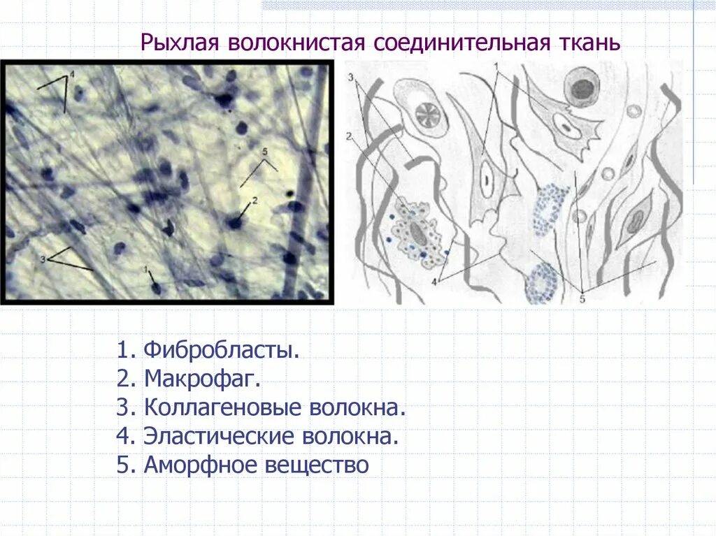 Макрофаги в тканях. Рыхлая волокнистая соединительная ткань. Рыхлая неоформленная соединительная ткань препарат. Рыхлая волокнистая неоформленная соединительная ткань гистология. Рыхлая волокнистая соединительная ткань гистология.