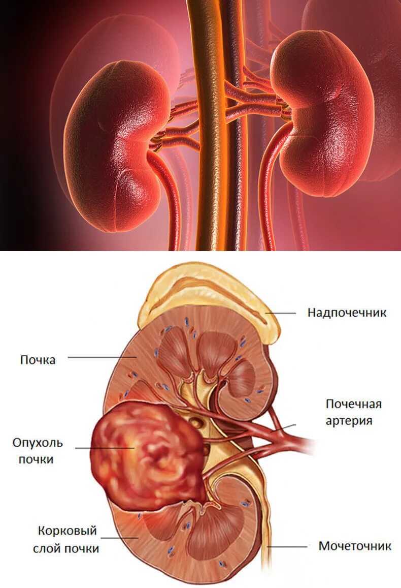 Почки. Стороны почки. Болит правая почка после