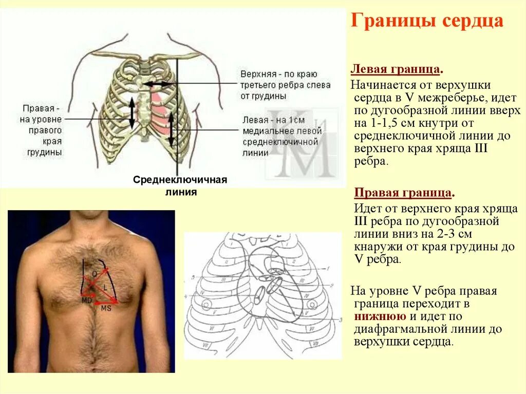 Верхняя граница сколько. Перкуссия верхней границы сердца. Левая граница сердца. Определение границ сердца. Определение грани Серда.