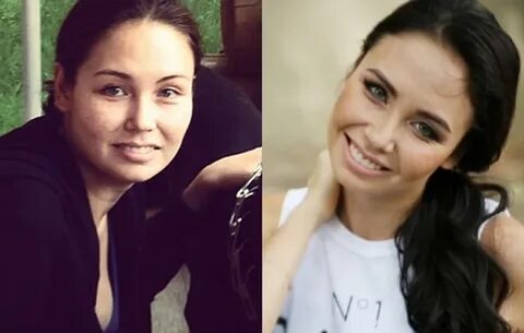 Утяшева до пластики
