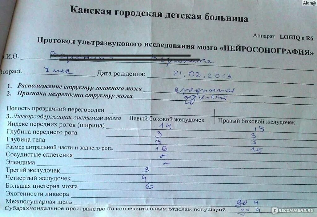 Направление на узи головного мозга у детей. Узи головного мозга у ребенка 3 месяца норма. Узи головного мозга расшифровка норма таблица. Узи головного мозга у новорожденных что показывает. Заключение узи головного мозга.