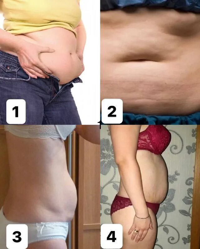 мой живот не про комплекс. капли для похудения комплекс. мой живот не про комплекс. продукты которые убирают жир с живота. пузо у девушки.