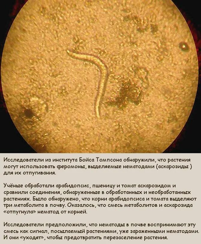 Как выглядят глисты в микроскопе