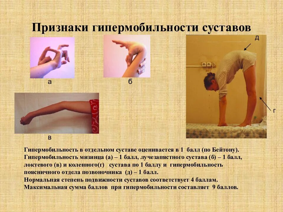 Симптом патологической подвижности
