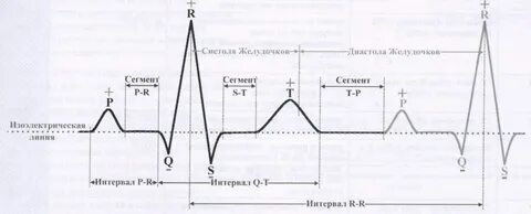 Схема экг