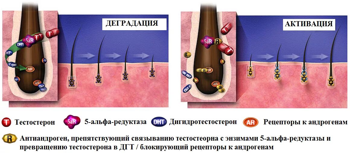 Дигидротестостерон. Воздействие дигидротестостерона на волос. Тестостерон и ДГТ. Волосяные фолликулы и дигидротестостерон. Уровень мужских гормонов