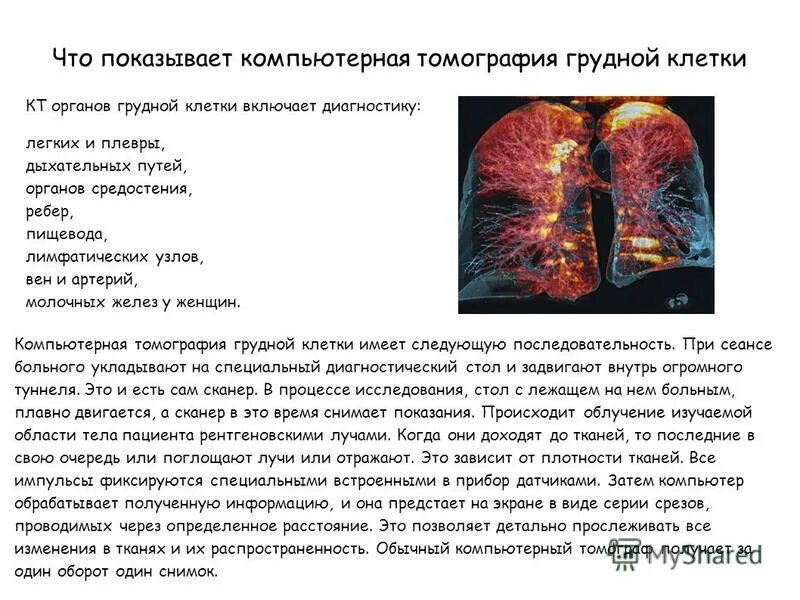 можно ли делать кт грудной клетки