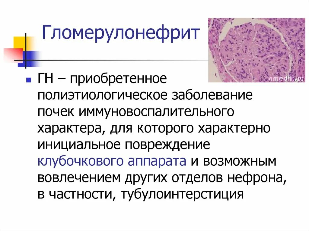 Заболевание почек гломерулонефрит. Хронический гломерулонефрит презентация. Гломерулонефрит у детей презентация. Острый гломерулонефрит презентация. Аутоиммунный гломерулонефрит.