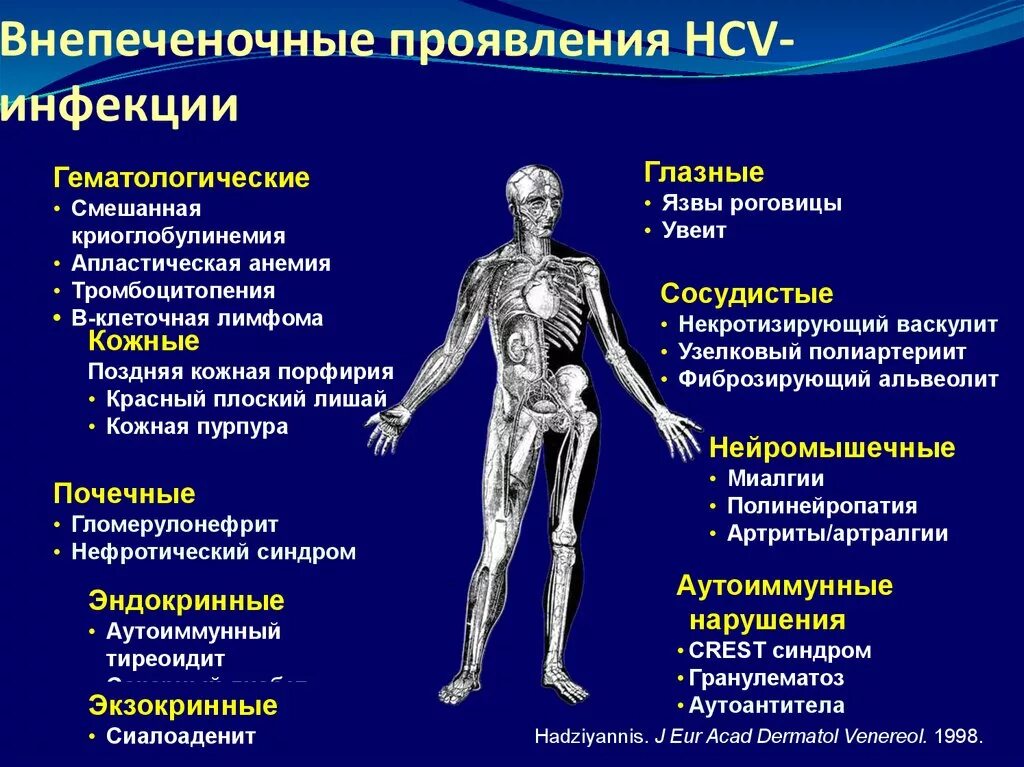 Внепеченочные проявления. Внепеченочные проявления гепатита с. Внепеченочные проявления HCV. Внепеченочные проявления хронического гепатита с.