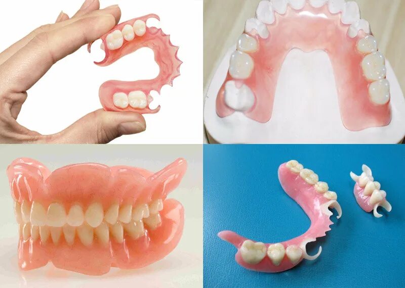Можно поставить съемные протезы зубов