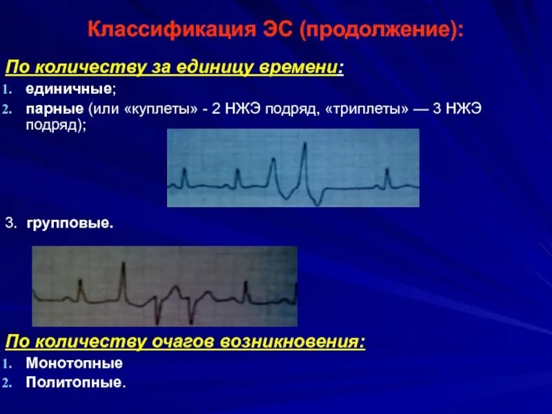 Kenz ecg. Этапы диагностического поиска. Одиночные нжэ. Экстрасистолы норма. Ступени диагностического поиска.