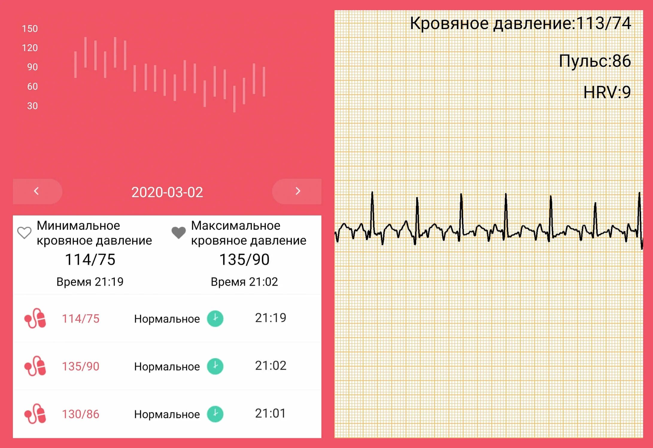 Сильное сердцебиение температура