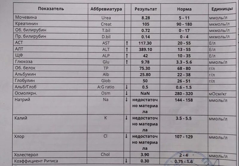 Креатинин мкмоль л норма. Анализ крови креатинин норма. Мочевина и креатинин в крови норма. Креатин норма у женщин в крови расшифровка у взрослых. Биохимический анализ крови креатин норма.