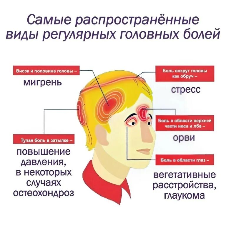 Причина боли области. Виды головной боли. Боль в голове. Головная боль локализация. Головные боли в голове.