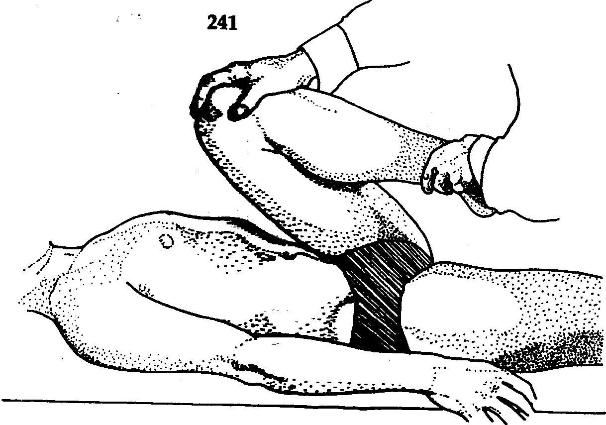 мышцы сгибающие бедро в тазобедренном суставе. сгибатель бедра мышца растягивание. мышцы сгибатели бедра в тазобедренном суставе. сгибает бедро в тазобедренном суставе. супинация бедра мышцы.