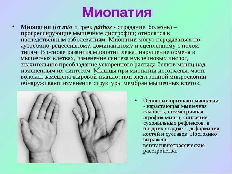 Клиническая миопатия. Миопатии прогрессирующие мышечные дистрофии. Миопатия клинические проявления. Миопатия генетическое заболевание.