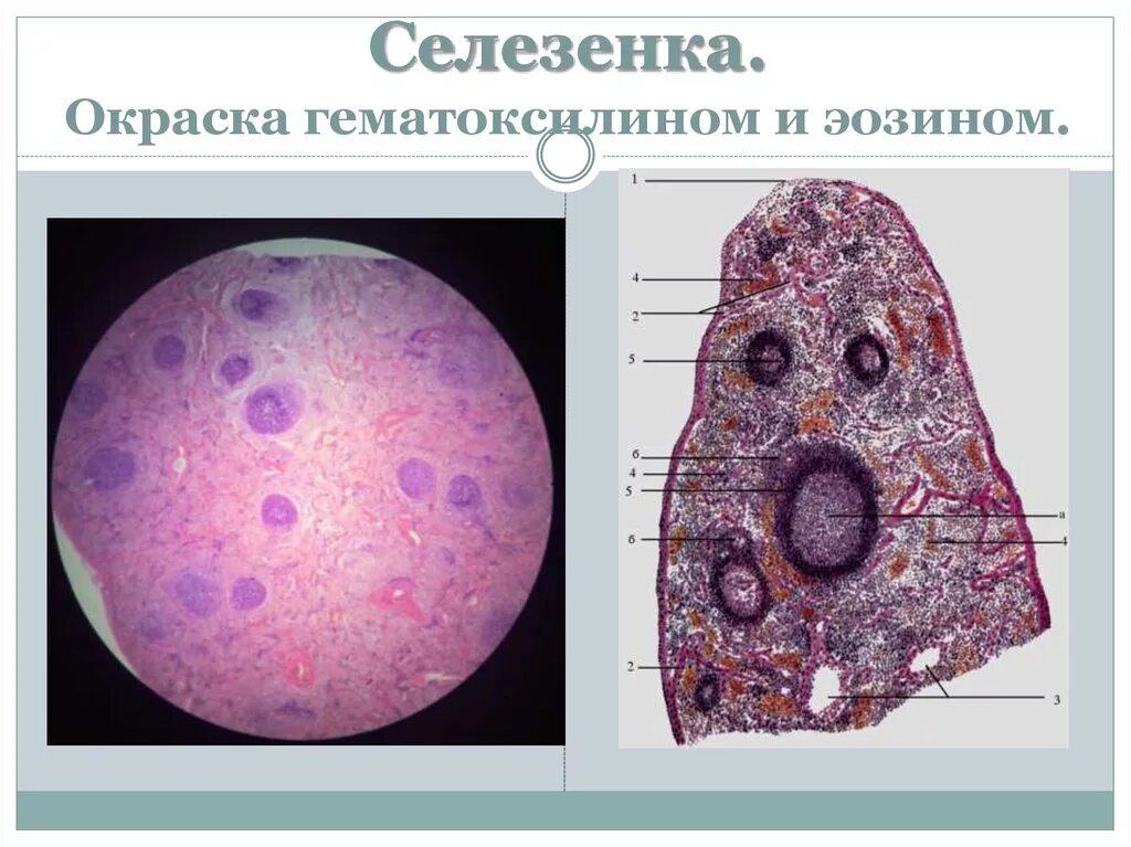 Селезенка гистология препарат. Препарат селезёнка окраска гематоксилин-эозин. Селещенка гемотоксилме эрщмн. Гематоксилин эозин гистология. В селезенке образуются клетки