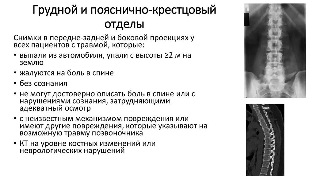 Локальный статус позвоночник. Ушиб спинного мозга шейного отдела. Повреждение поясничного отдела позвоночника симптомы. Ушиб поясного отдела позвоночника. Травма пояснично крестцового отдела позвоночника.