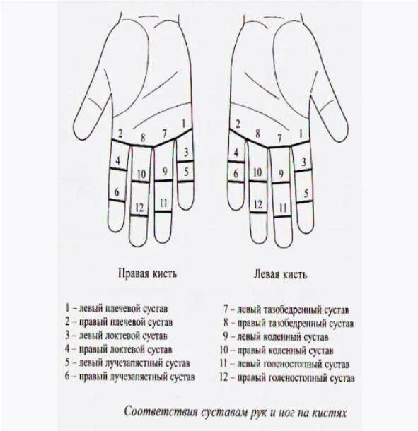 Кисти правой и левой руки. Коды на левое запястье. Коды на запястье левой руки. Ноющая боль в левой кисти