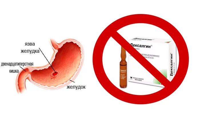Уколы от язвы желудка. Препараты уколы от язвы желудка. Препараты от язвы двенадцатиперстной