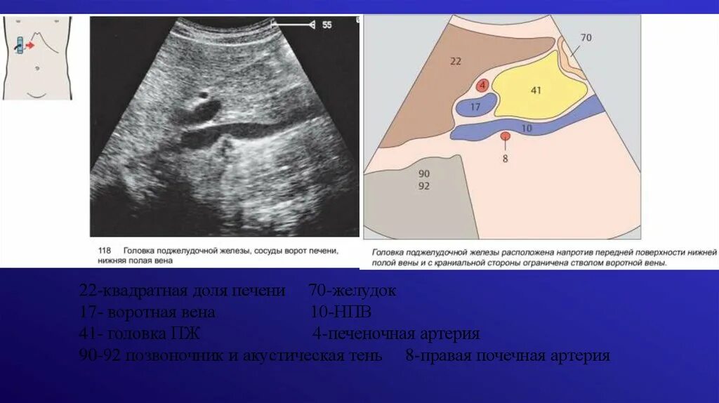 Нижняя полая Вена ультразвуковые показатели. УЗИ поджелудочной железы схема. Ультразвуковая анатомия поджелудочной железы.