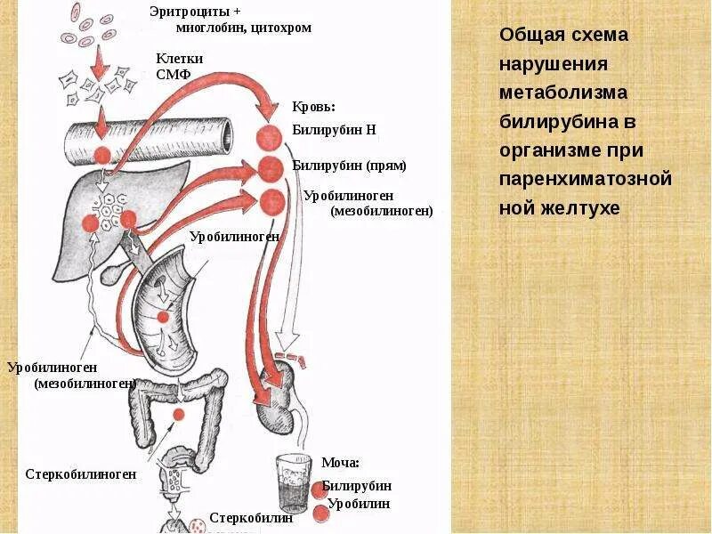 Печеночная желтуха билирубин. Нарушение метаболизма билирубина при гемолитической желтухе. паренхиматозная желтуха патофизиология. общая схема метаболизма билирубина в организме. метаболизм билирубина схема.