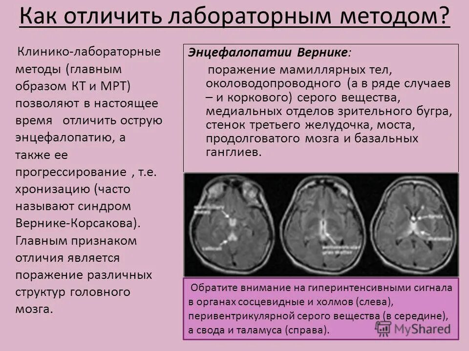 Вич энцефалопатия