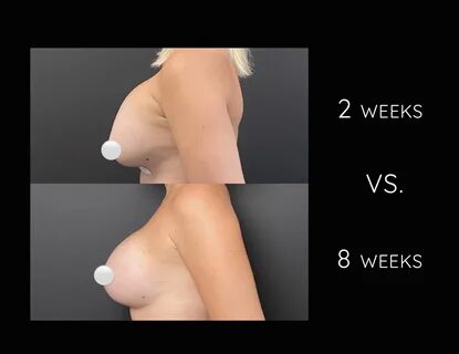 Busty hard nipple (82) фото 